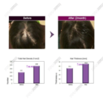 Dr. CYJ  Hair Filler - Image 4