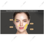 Etrebelle 200mg - Image 2